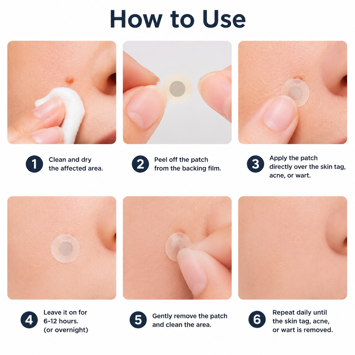 ODALIT® 2-in-1 Microneedle & Hydrocolloid Patch🍀| Removes Raised Moles, Acne, Flat Warts & Skin Tags | Helps Improve Wrinkles, Scars & Blemishes | Invisible Patches for Face & Body
